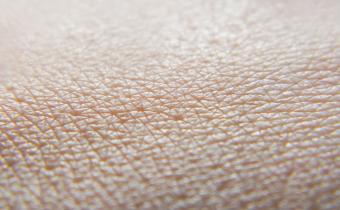 Koža je najväčším orgánom ľudského tela